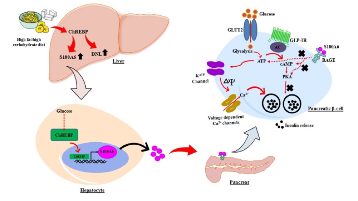 IIT Mandi identifies link between fatty liver and type 2 diabetes